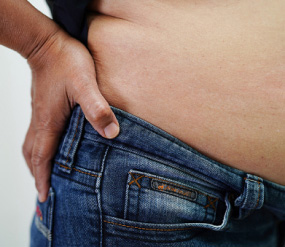 Obesity - Body Mass Index (BMI) >25